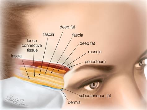 academy anatomy temples cutaneous