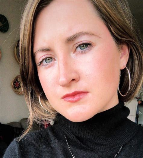 how long for doxycycline to work for acne