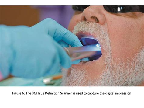 3M true definition scanner | PPTX