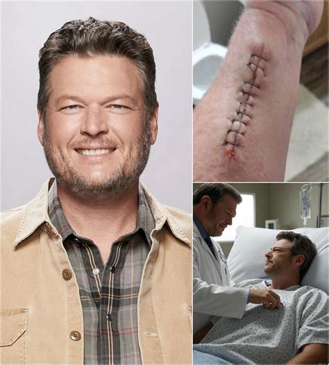 Banjo - Blake Shelton Breaks His Silence After Surgery — “I’m Not