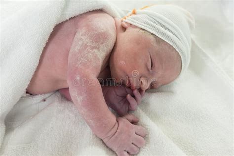 newborn   postpartum crib  covered  vernix caseosa