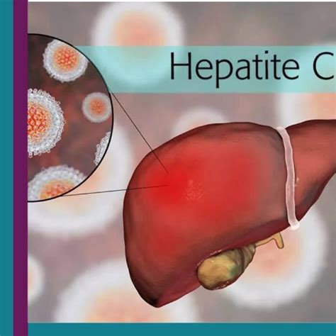 O Que Causa Hepatite C - Hepatite C - Cighep