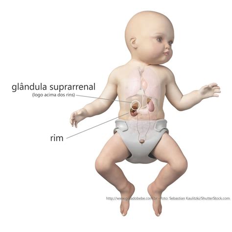 O Que É Hiperplasia Adrenal Congênita - Hiperplasia Adrenal Congênita (HAC) – Guia do Bebê