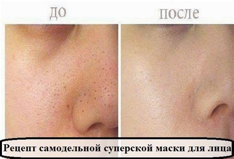 Секреты красоты и здоровья.: Рецепт самодельной суперской маски для лица