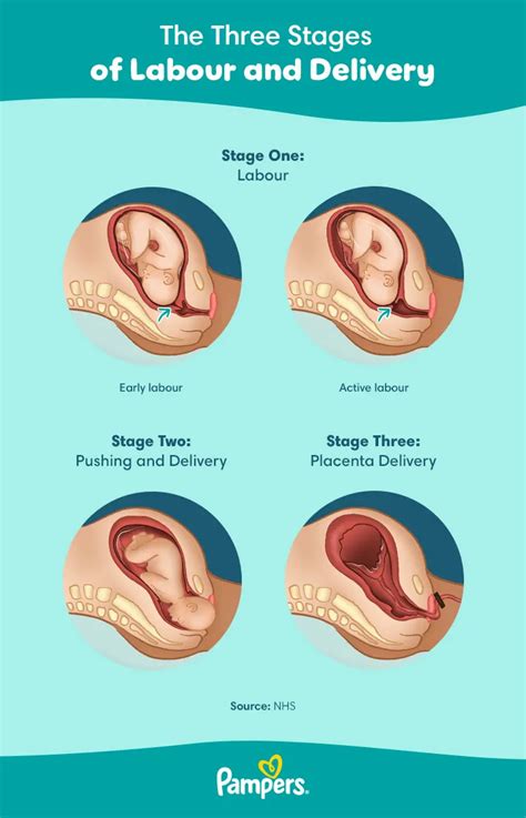 Stages Of Labor And Delivery Stages Of Labor Chart