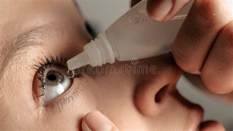 Beauty Girl Dripping Eye Drops, Introduces Them Under Eyelid into Right ...