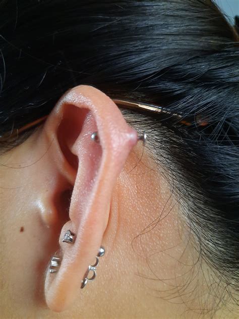 Ear Piercings Infection Bump