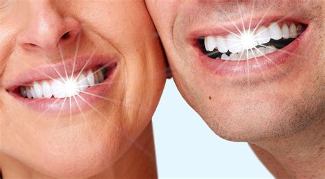 Teeth Whitening San Jose, CA | Dental Solutions