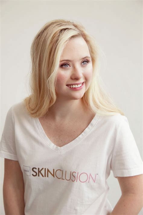 model   syndrome st louis native donating garments