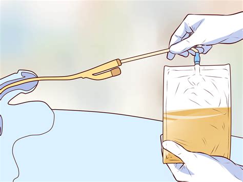 Come Inserire un Catetere: 11 Passaggi (Illustrato)