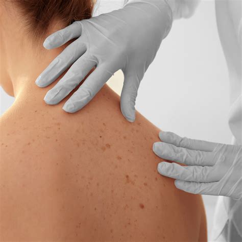 Will Patients With Chronic Inflammatory Condition Need Repeat Cortisone