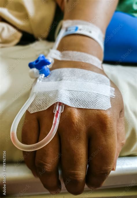 A patient's hand in a hospital were connected to the saline solution ...