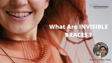 invisible braces  delhi clinic eximus