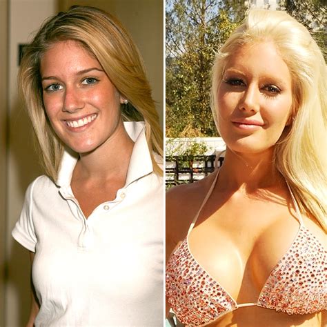 Celebrity Before And After Plastic Surgery Breast