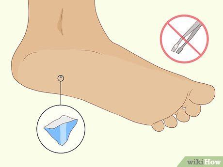 how to get glass out of a foot