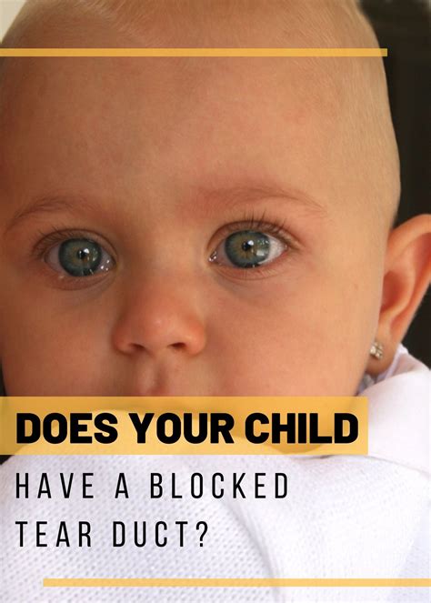 Blocked Tear Duct Baby