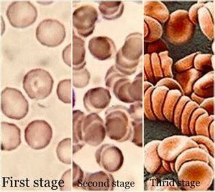 Three stages of sedimentation rate. | Download Scientific Diagram