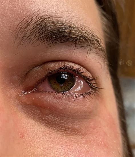 20 Disgusting Pictures That Are Oddly Fascinating, Taken From The ...
