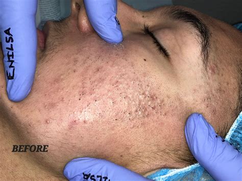 This is K's before and... - Enilsa Brown aka thequeenofpops | Facebook