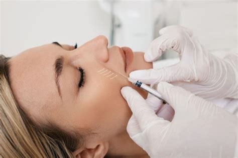 botox  nasolabial folds smooth laugh lines  expert