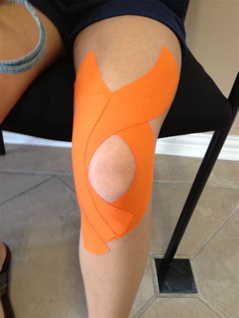 Knee Taping