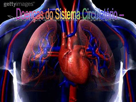 Doenças Dos Sistema Circulatorio - PPT - Doenças do Sistema Circulatório -- PowerPoint Presentation, free ...