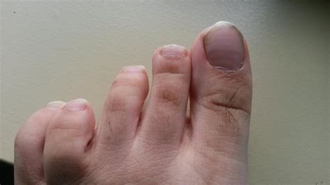 beaus lines  werent    time  clipped