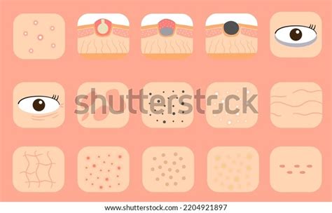 skin problem illustration set vector skin stock vector royalty