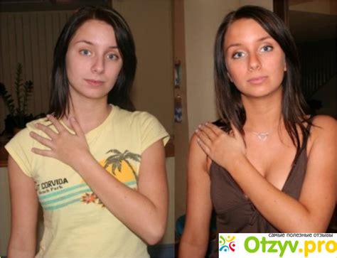ST. MORIZ отзывы врачей отрицательные и реальные, развод или правда ...