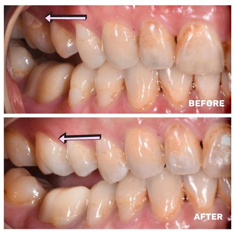 BEFORE & AFTER | Dr. Michelle Lee