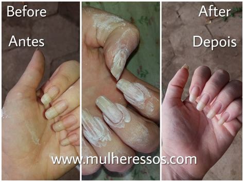 Como Tirar O Amarelado Das Unhas - Receita caseira pra tirar o amarelado da unha em questão de minutos ...