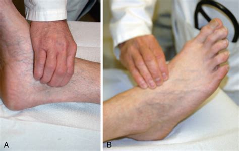 Peripheral Artery Disease: Clinical Evaluation - Clinical GateClinical Gate