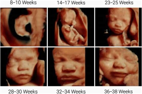 3D/4D 5D HD Ultrasound Packages | Early Gender