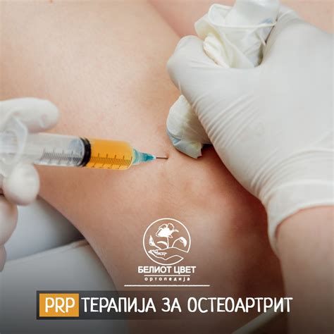 Инјекции - ПЗУ Белиот Цвет