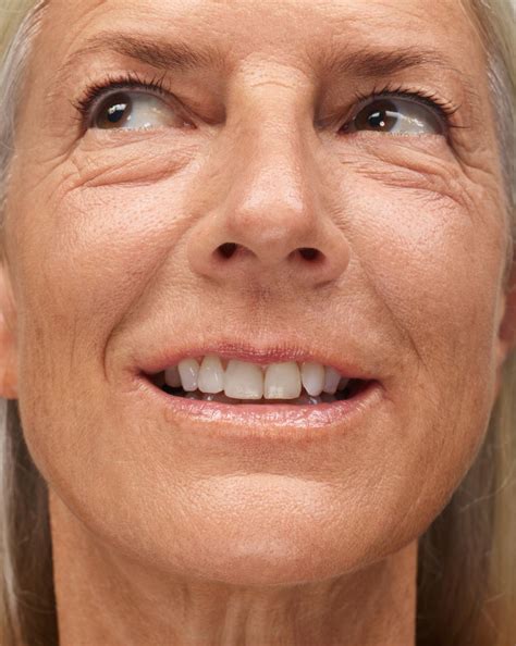 open picture gallery 8