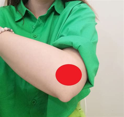 Shockwave Therapy Can Help with Tennis Elbow (Lateral Elbow Pain)