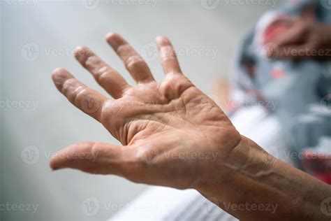 Hand tendon disease. Cropped woman hand with dense node under finger