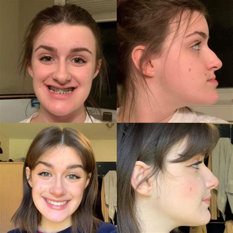 Unbelievable Sally Brompton Globe Transformations You Have To See! - heg6ur2