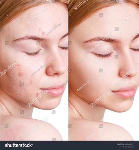 InfluencerGoneWild's Most Dramatic Transformation YET: See The Before & After Image 5
