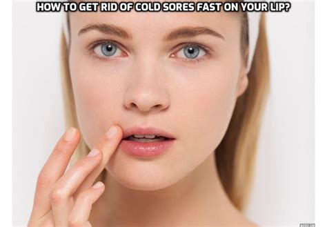 Treating Cold Sores – How to Get Rid of Cold Sores Fast on Your Lip ...