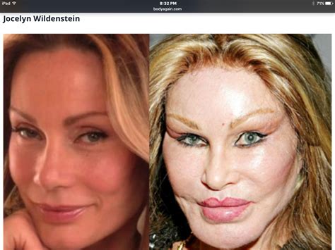 Phun Forum Celebrity Extra: The Truth About Celebrity Plastic Surgery! - qqj6apz