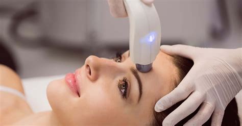 How Do Laser Treatments Work For Skin Tags? – Skintify