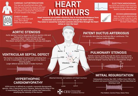 heart murmurs