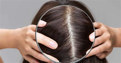 scalp analysis rusila spa