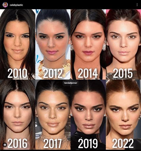 rate kendall jenner    plastic surgery rvindictaratecelebs
