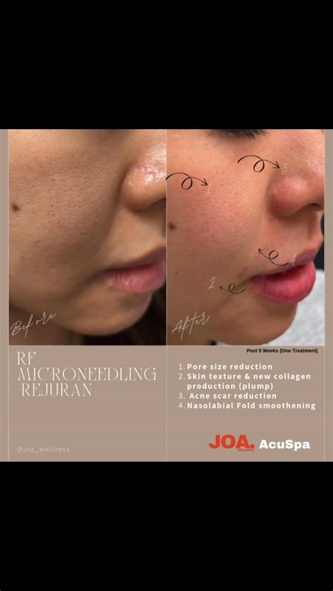 JOA Wellness Private Luxury Acupuncture & Fitness Studio | Feeling