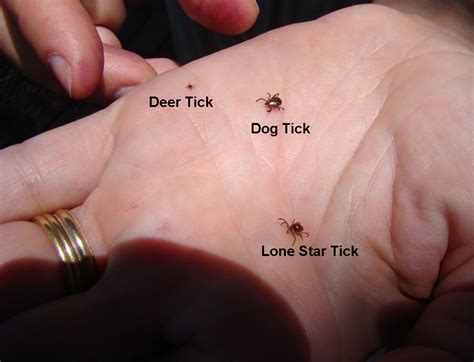 Rurification | Robin Edmundson: Ticks