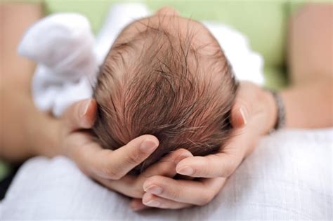 plagiocephaly    parent    baby flat head