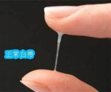 怎麼從白帶拉絲看排卵？ - 每日頭條
