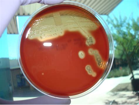 alpha  beta hemolytic streptococcus red mountain microbiology